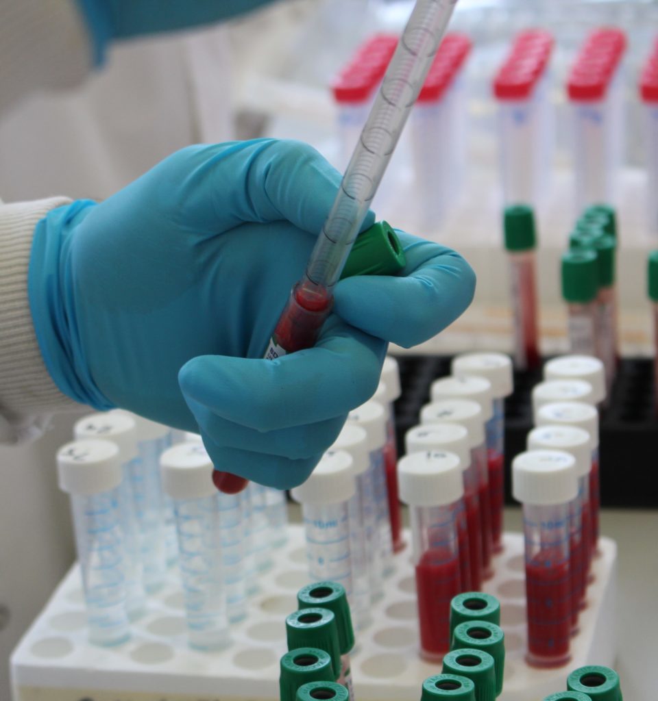 icmr approves antigen testing kits