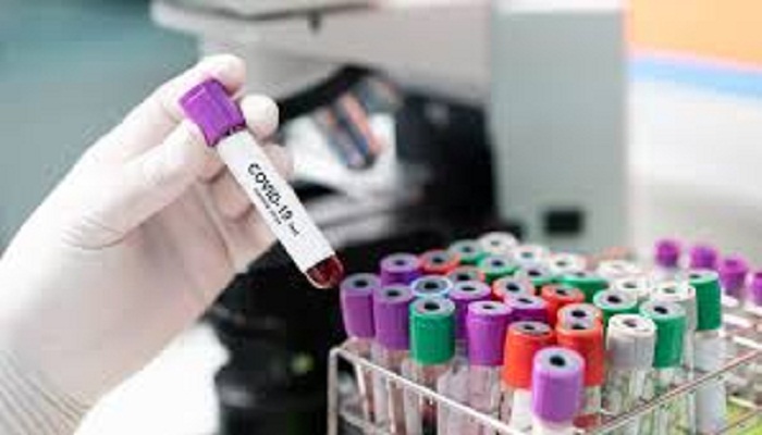Covid-19 rapid antigen testing to