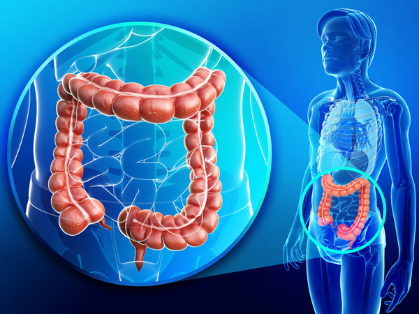 Colon infection foods