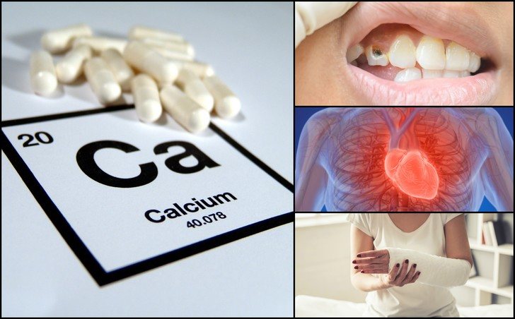Women Calcium deficiency