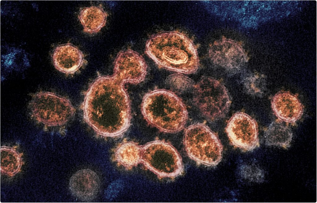 Malaysia detects new coronavirus strain