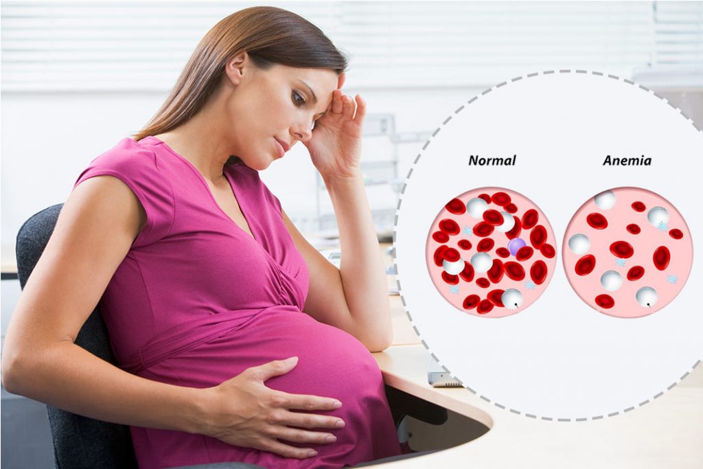 Pregnancy anemia problem