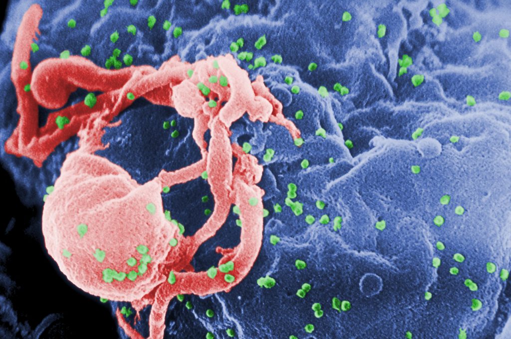 Bathinda HIV infected blood case
