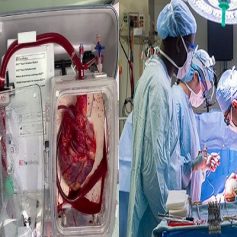 Doctors dead heart transplant