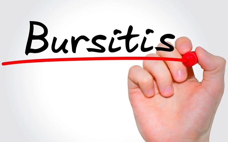 Bursitis home remedies