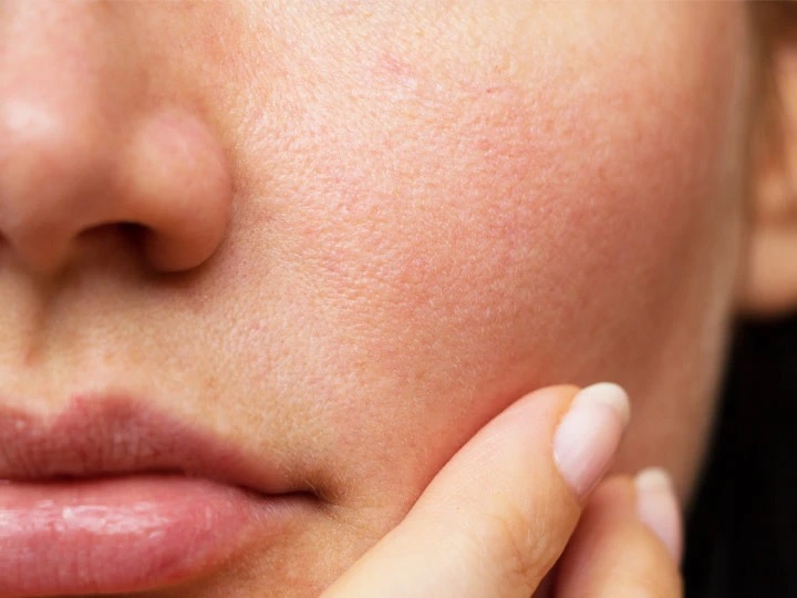 Open pores tips
