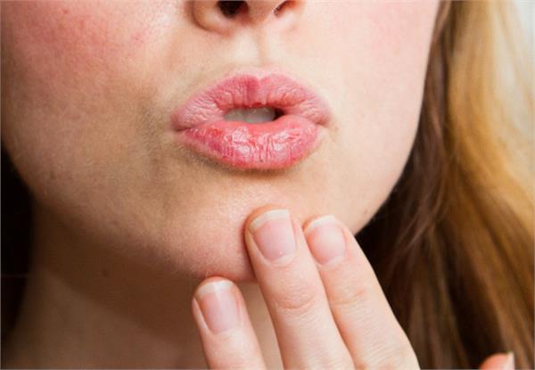 Dry Lips care tips