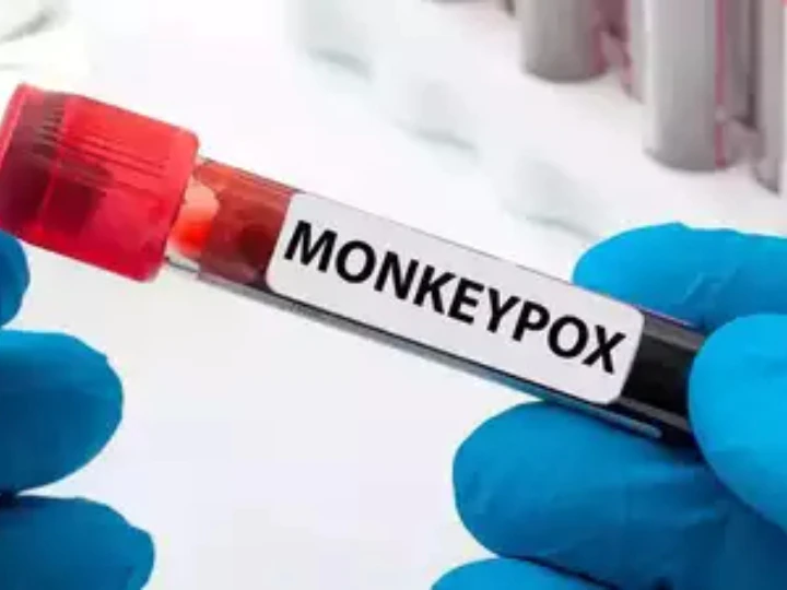 monkeypox delhi fifth patient