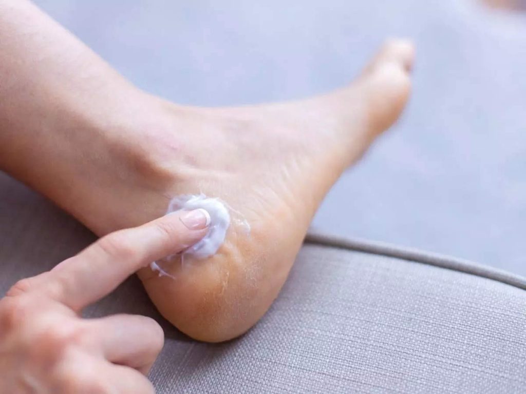 Foot Care remedies