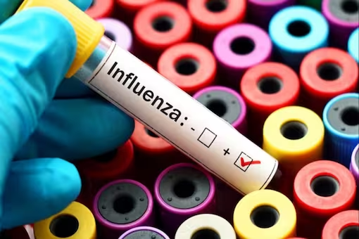 Himachal H3N2 Influenza Virus 