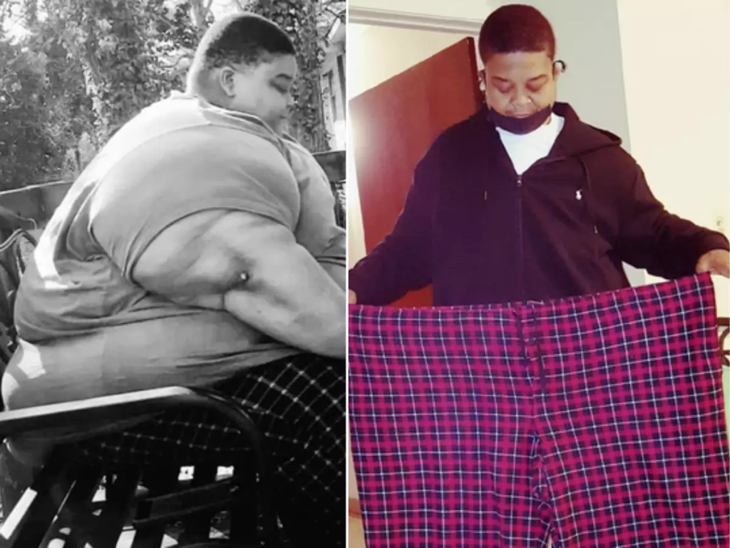 Man loses 165 kg 