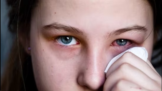 eye infection conjunctivitis news